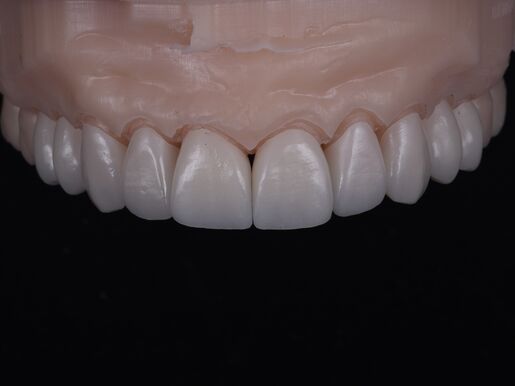 Natural Restoration DSD Lab 02