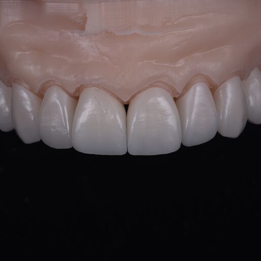 Natural Restoration DSD Lab 02