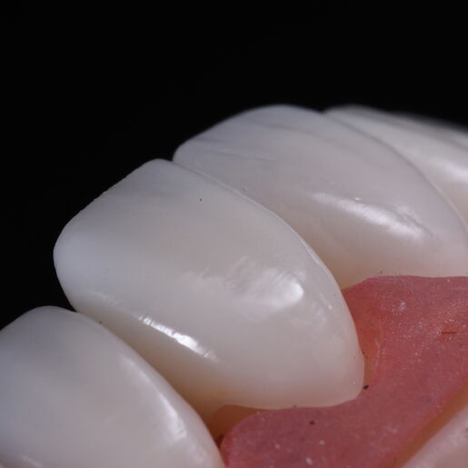 Natural Restoration DSD Lab 03