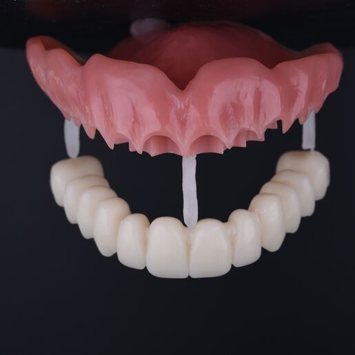 Denture dsd 1