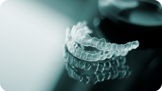 RESIDENCY ALIGNERS Aligners Challenges