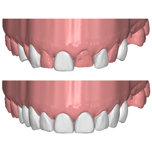 DSD Direct Pressed 1
