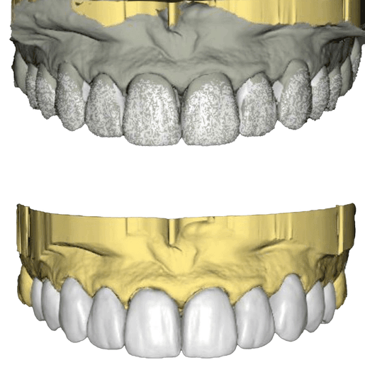 DSD Natural Restoration Design per unit