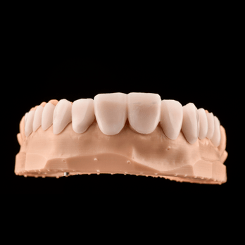 DSD Shell Manufacture