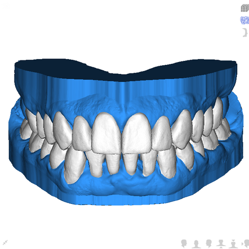 UPPERLOWER PRINCIPAL
