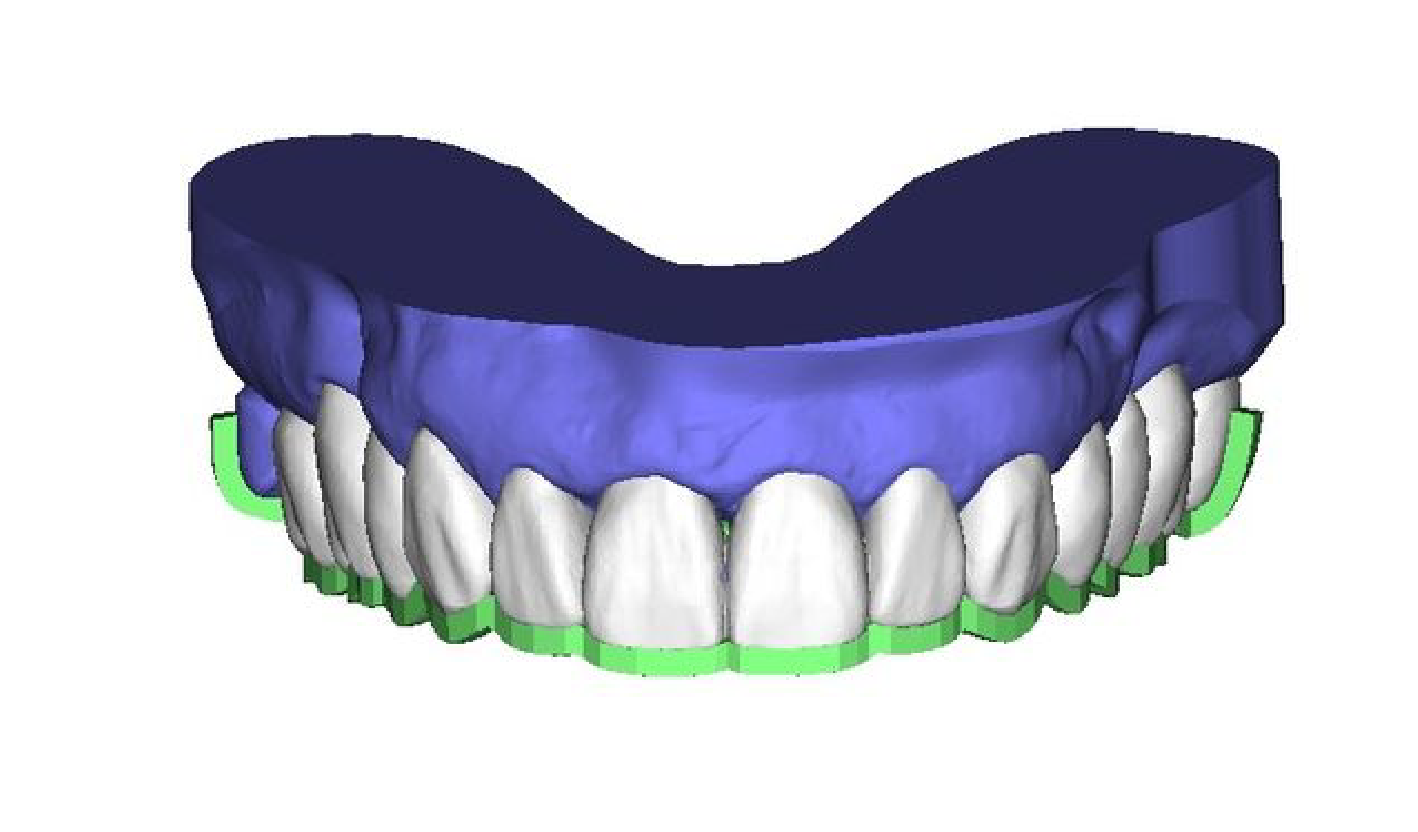 PLANNING CENTER Restore